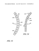 Minimally invasive apparatus to manipulate and revitalize spinal column     disc diagram and image