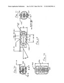 Minimally invasive apparatus to manipulate and revitalize spinal column     disc diagram and image