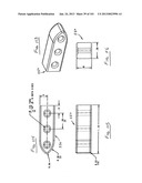 Minimally invasive apparatus to manipulate and revitalize spinal column     disc diagram and image