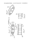 Minimally invasive apparatus to manipulate and revitalize spinal column     disc diagram and image