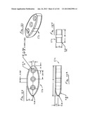 Minimally invasive apparatus to manipulate and revitalize spinal column     disc diagram and image