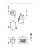 Minimally invasive apparatus to manipulate and revitalize spinal column     disc diagram and image