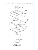 Minimally invasive apparatus to manipulate and revitalize spinal column     disc diagram and image