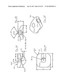 Minimally invasive apparatus to manipulate and revitalize spinal column     disc diagram and image