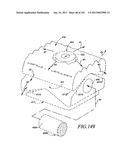 Minimally invasive apparatus to manipulate and revitalize spinal column     disc diagram and image