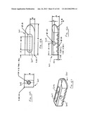 Minimally invasive apparatus to manipulate and revitalize spinal column     disc diagram and image