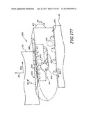 Minimally invasive apparatus to manipulate and revitalize spinal column     disc diagram and image