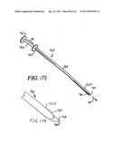 Minimally invasive apparatus to manipulate and revitalize spinal column     disc diagram and image