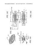 Minimally invasive apparatus to manipulate and revitalize spinal column     disc diagram and image