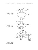 Minimally invasive apparatus to manipulate and revitalize spinal column     disc diagram and image