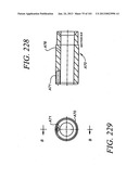 Minimally invasive apparatus to manipulate and revitalize spinal column     disc diagram and image