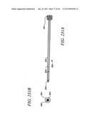 Minimally invasive apparatus to manipulate and revitalize spinal column     disc diagram and image