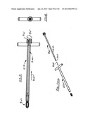 Minimally invasive apparatus to manipulate and revitalize spinal column     disc diagram and image