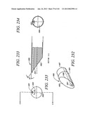 Minimally invasive apparatus to manipulate and revitalize spinal column     disc diagram and image