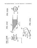 Minimally invasive apparatus to manipulate and revitalize spinal column     disc diagram and image