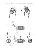 Minimally invasive apparatus to manipulate and revitalize spinal column     disc diagram and image