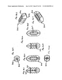 Minimally invasive apparatus to manipulate and revitalize spinal column     disc diagram and image