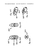 Minimally invasive apparatus to manipulate and revitalize spinal column     disc diagram and image