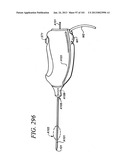 Minimally invasive apparatus to manipulate and revitalize spinal column     disc diagram and image