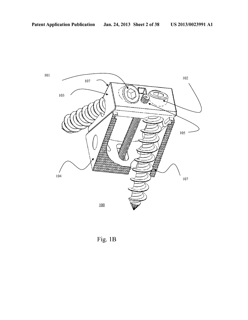 BI-DIRECTIONAL FIXATING TRANSVERTEBRAL BODY SCREWS AND POSTERIOR CERVICAL     AND LUMBAR INTERARTICULATING JOINT CALIBRATED STAPLING DEVICES FOR SPINAL     FUSION - diagram, schematic, and image 03