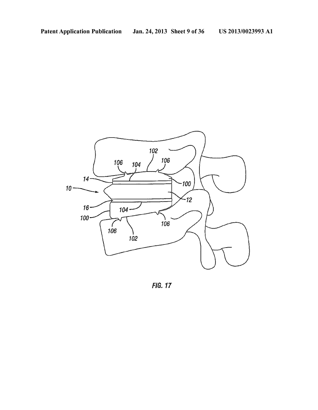 Expandable Fusion Device and Method of Installation Thereof - diagram, schematic, and image 10