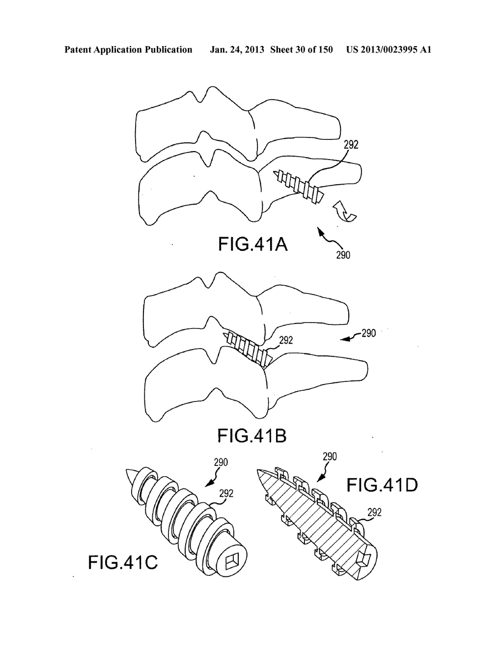 VERTEBRAL JOINT IMPLANTS AND DELIVERY TOOLS - diagram, schematic, and image 31