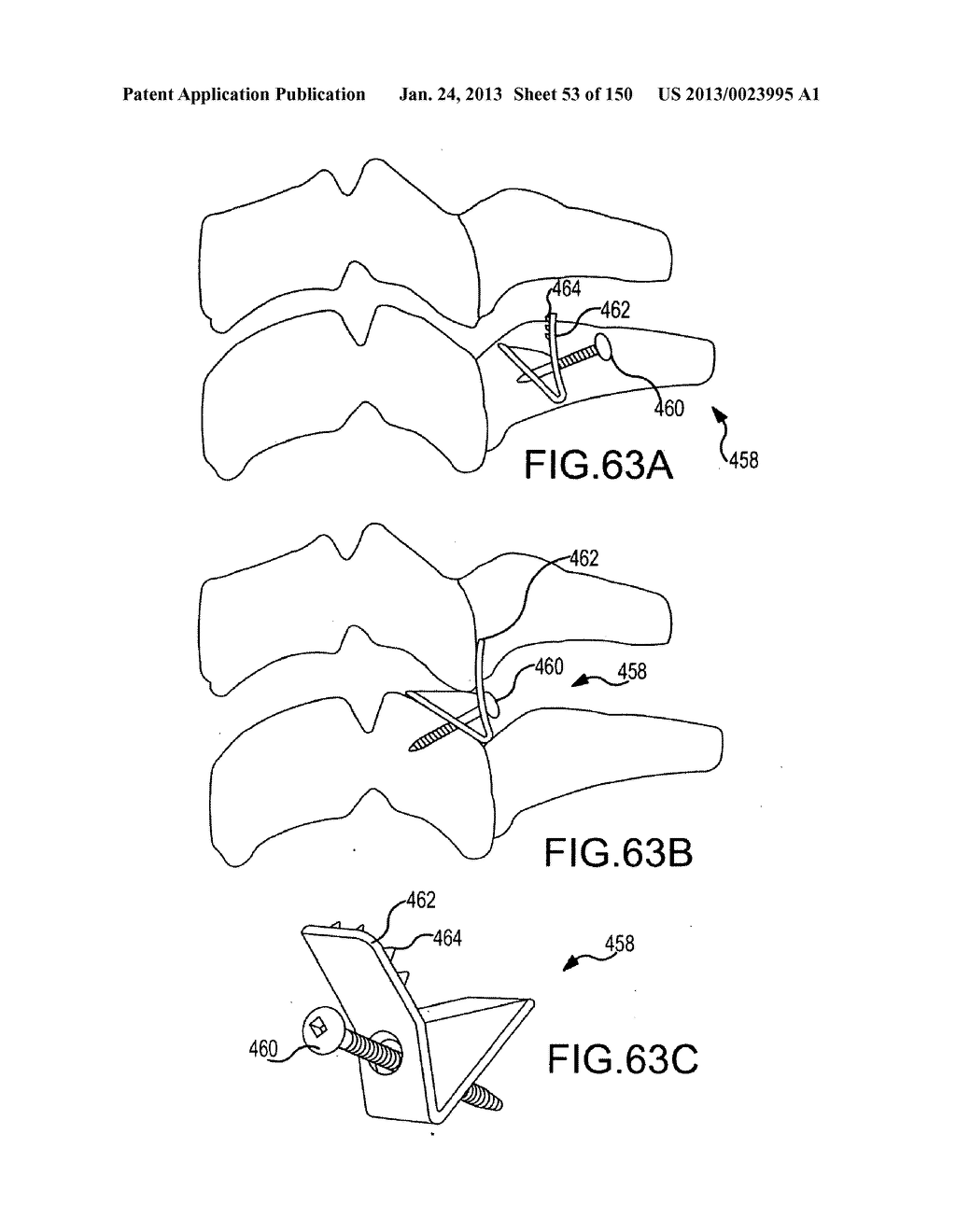 VERTEBRAL JOINT IMPLANTS AND DELIVERY TOOLS - diagram, schematic, and image 54