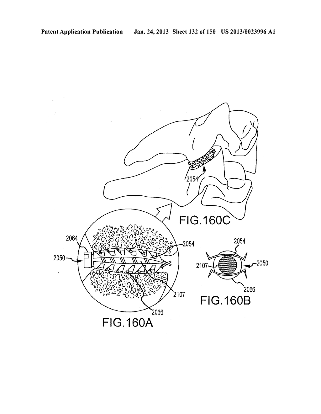 VERTEBRAL JOINT IMPLANTS AND DELIVERY TOOLS - diagram, schematic, and image 133