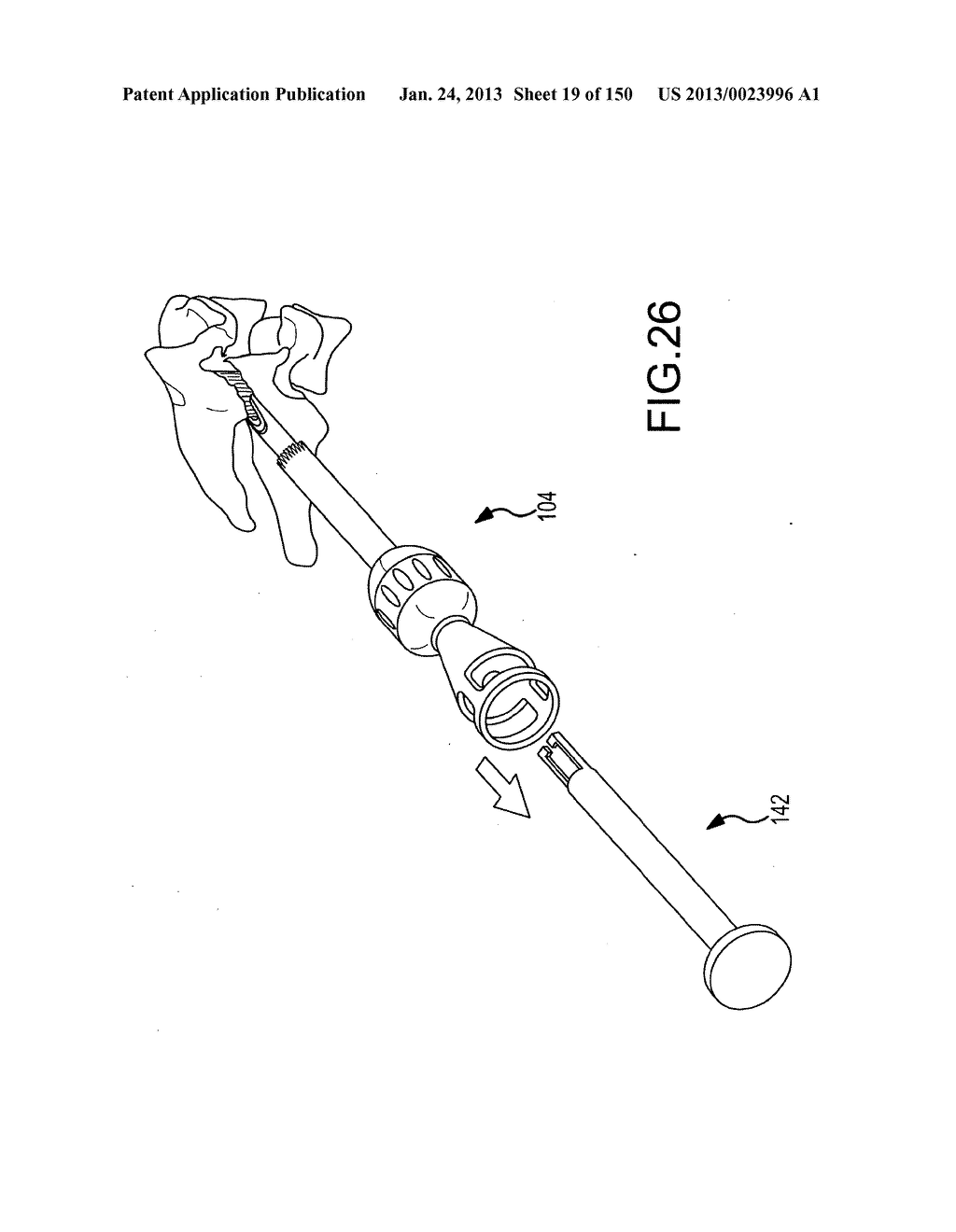 VERTEBRAL JOINT IMPLANTS AND DELIVERY TOOLS - diagram, schematic, and image 20