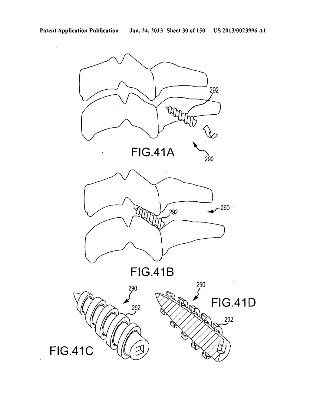 VERTEBRAL JOINT IMPLANTS AND DELIVERY TOOLS - diagram, schematic, and image 31