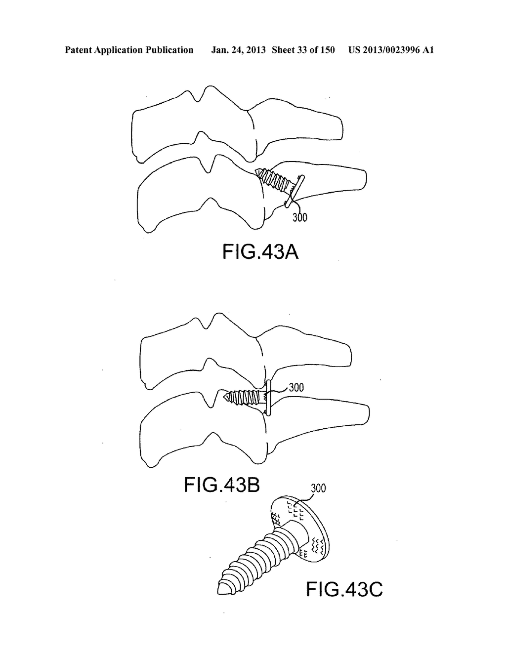 VERTEBRAL JOINT IMPLANTS AND DELIVERY TOOLS - diagram, schematic, and image 34