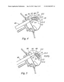 SYSTEM FOR REPLACING AN INTERVERTEBRAL DISC diagram and image