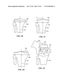 Patient Selectable Joint Arthroplasty Devices and Surgical Tools diagram and image