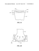 Patient Selectable Joint Arthroplasty Devices and Surgical Tools diagram and image