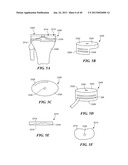 Patient Selectable Joint Arthroplasty Devices and Surgical Tools diagram and image