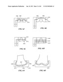 Patient Selectable Joint Arthroplasty Devices and Surgical Tools diagram and image