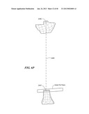 Patient Selectable Joint Arthroplasty Devices and Surgical Tools diagram and image