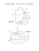 Patient Selectable Joint Arthroplasty Devices and Surgical Tools diagram and image