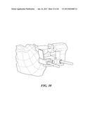 Patient Selectable Joint Arthroplasty Devices and Surgical Tools diagram and image