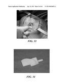 Patient Selectable Joint Arthroplasty Devices and Surgical Tools diagram and image