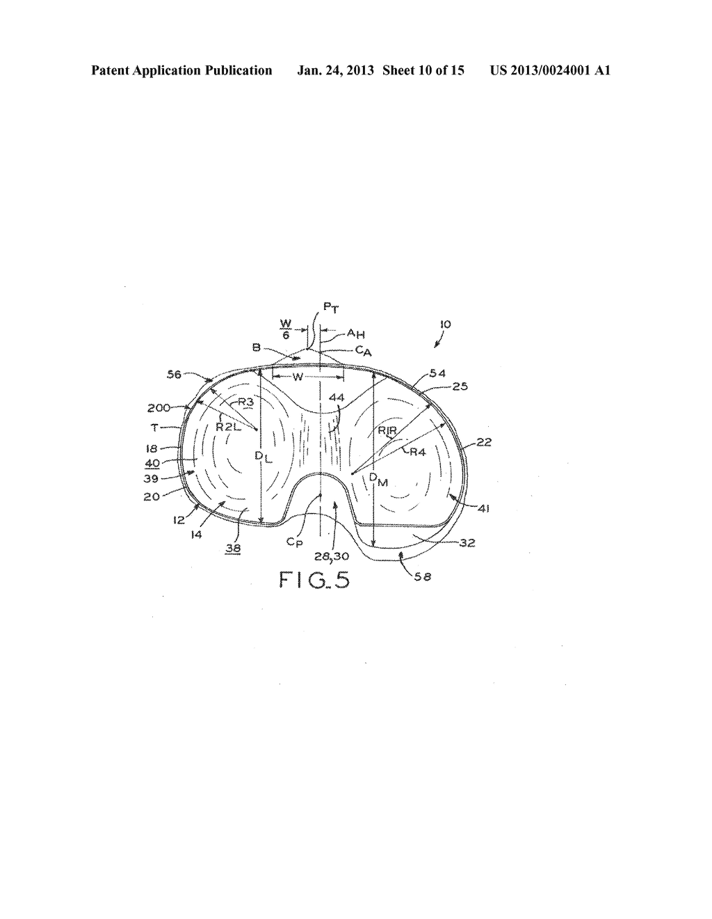 ASYMMETRIC TIBIAL COMPONENTS FOR A KNEE PROSTHESIS - diagram, schematic, and image 11