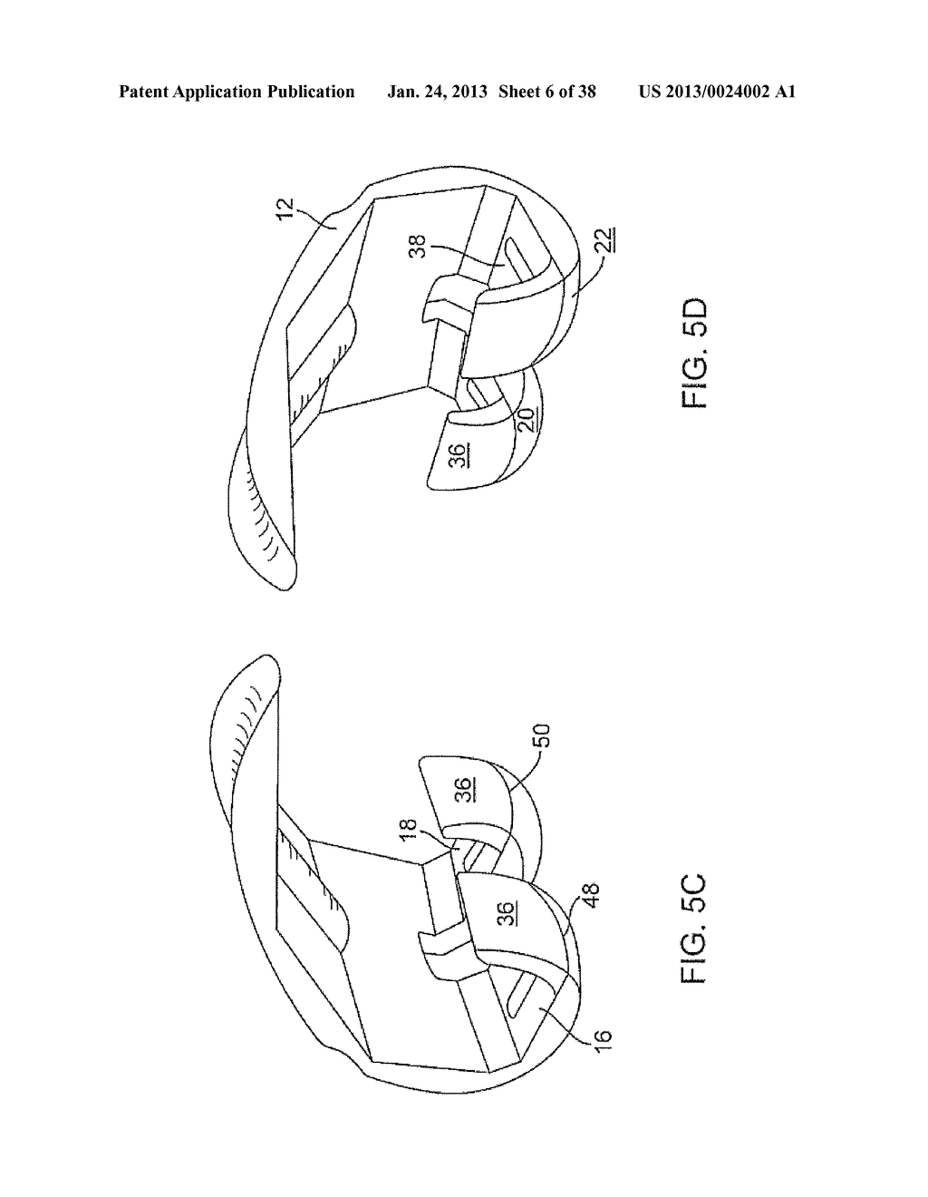 SYSTEMS AND METHODS FOR PROVIDING DEEPER KNEE FLEXION CAPABILITIES FOR     KNEE PROSTHESIS PATIENTS - diagram, schematic, and image 07