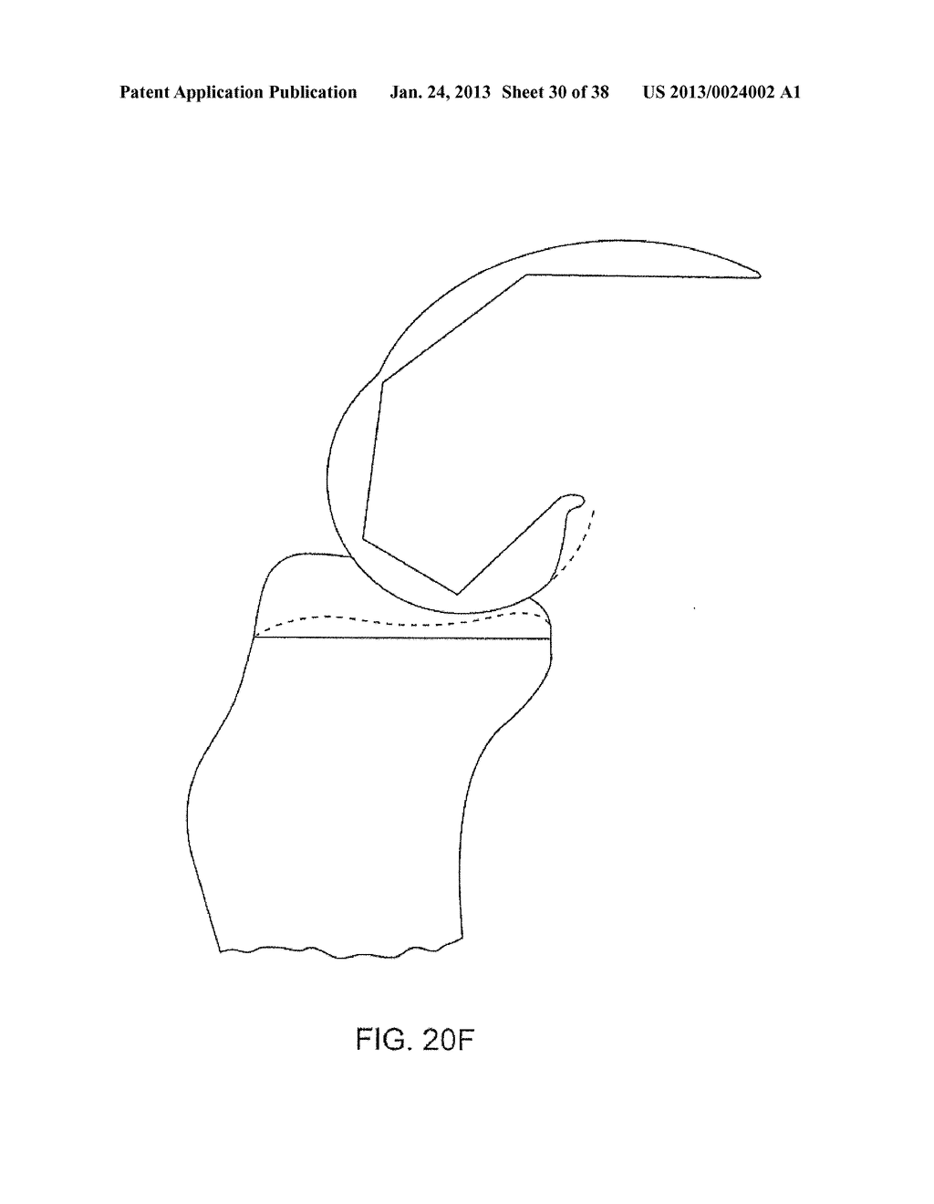 SYSTEMS AND METHODS FOR PROVIDING DEEPER KNEE FLEXION CAPABILITIES FOR     KNEE PROSTHESIS PATIENTS - diagram, schematic, and image 31