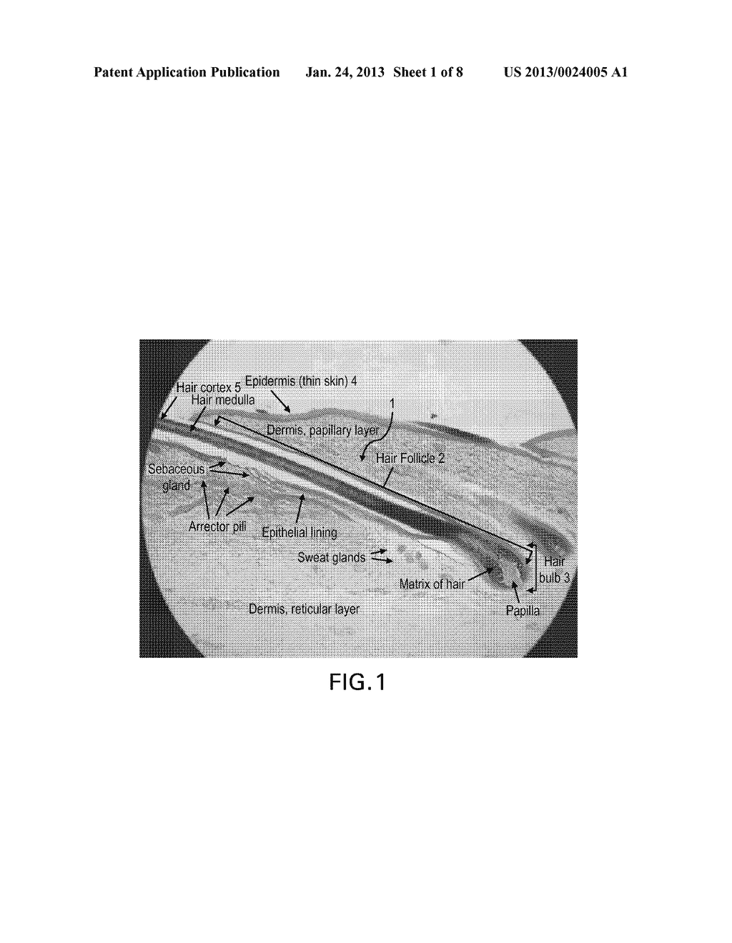 COMPOSITE IMPLANT - diagram, schematic, and image 02