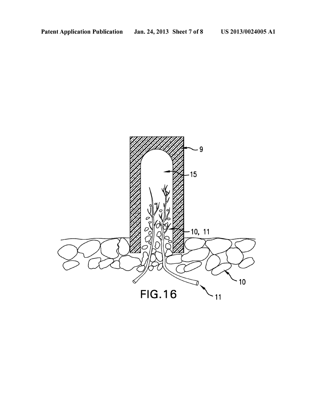 COMPOSITE IMPLANT - diagram, schematic, and image 08