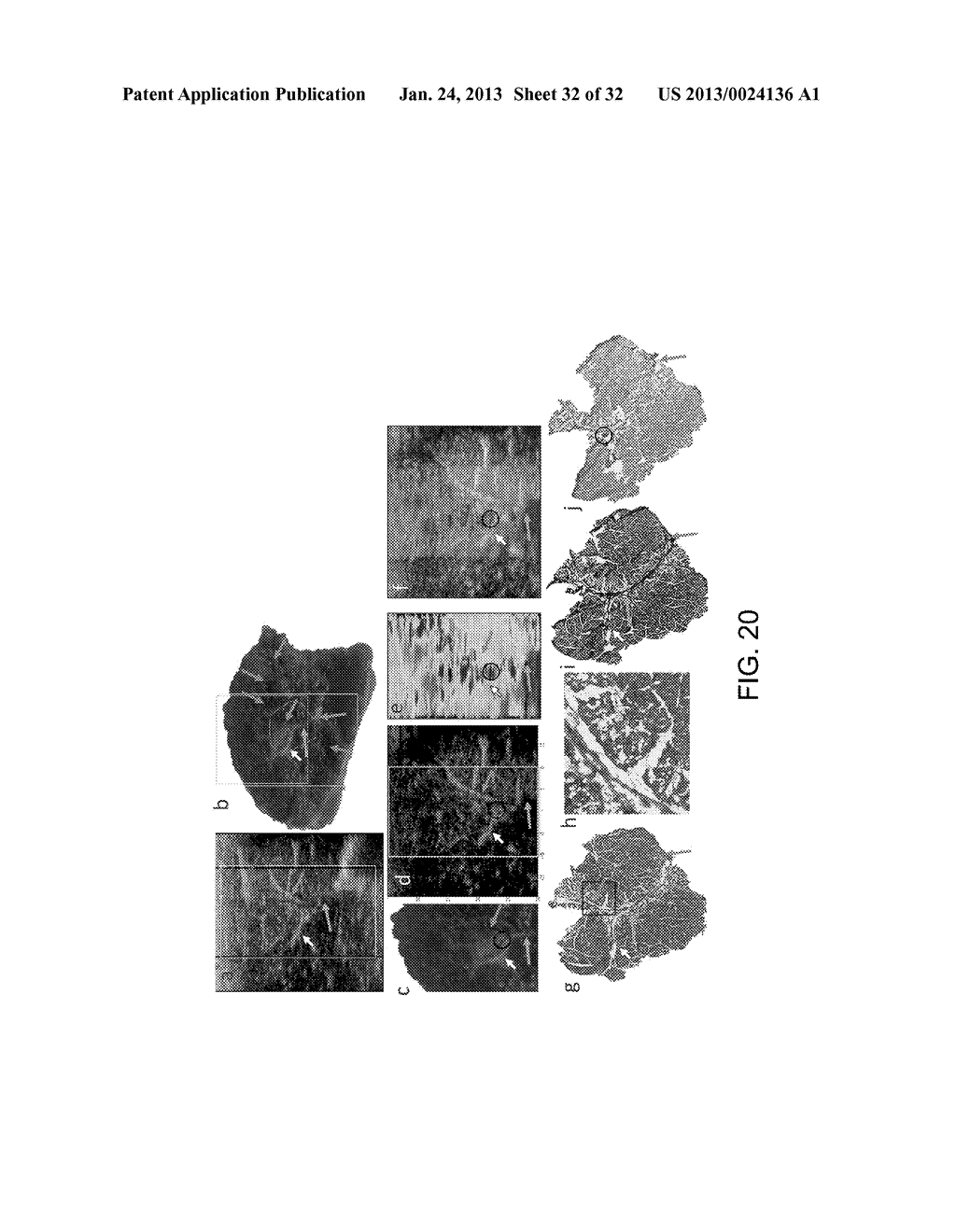 METHODS, SYSTEMS AND COMPUTER READABLE MEDIA FOR APPLYING MULTI-PUSH     ACOUSTIC RADIATION FORCE TO SAMPLES AND MONITORING A RESPONSE TO QUANTIFY     MECHANICAL PROPERTIES OF SAMPLES - diagram, schematic, and image 33