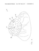 Process for Making Knit Embroidered Conductive Gloves diagram and image