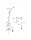 LOADING DILATOR diagram and image