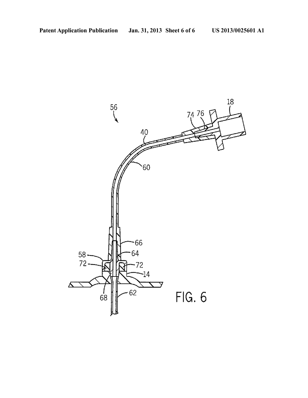 TRACHEAL TUBE WITH REINFORCED PROXIMAL EXTENSION - diagram, schematic, and image 07