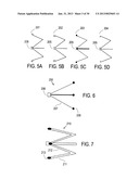 METHODS AND DEVICES FOR DEPLOYMENT INTO A LUMEN diagram and image